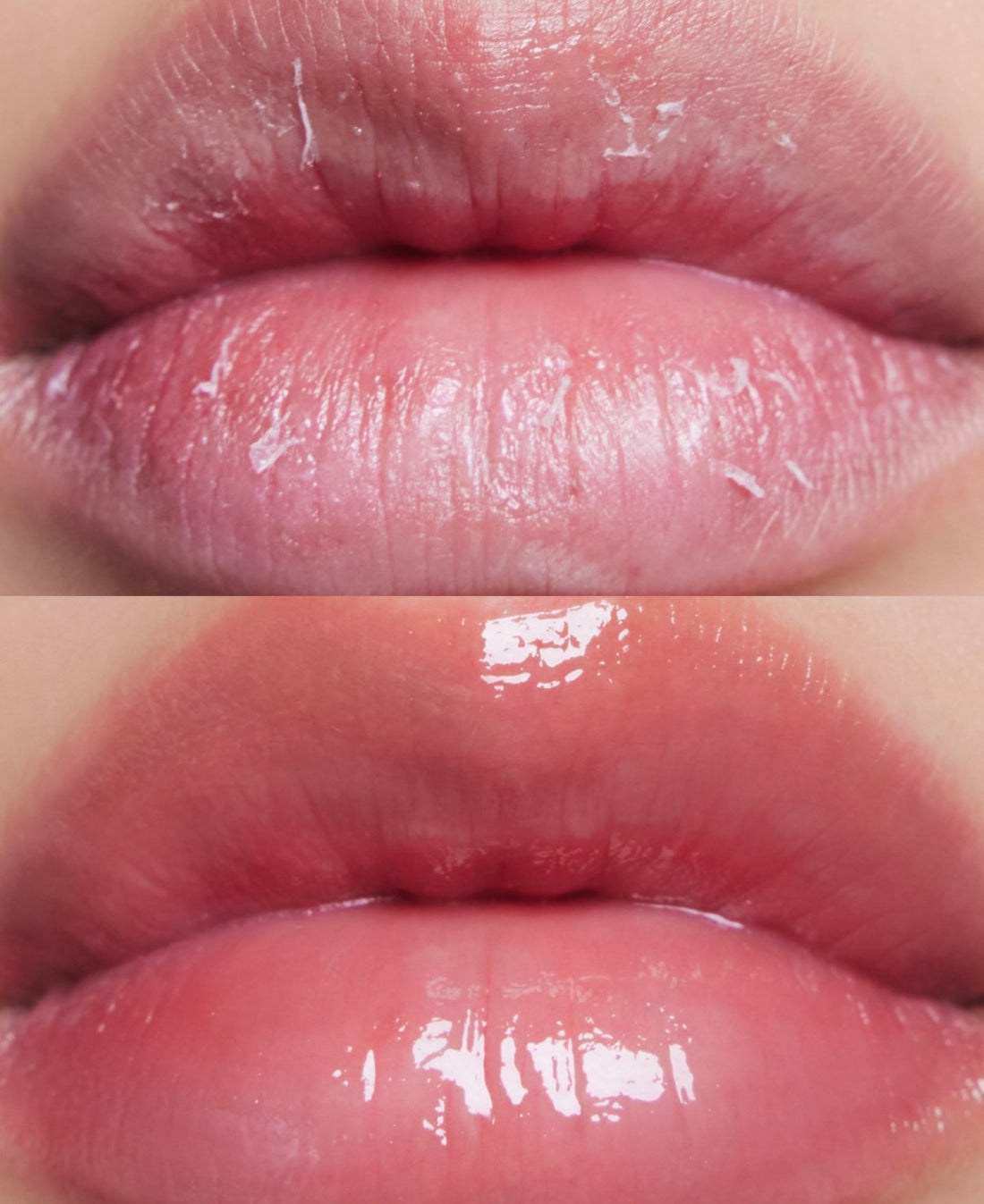 Lip Mask