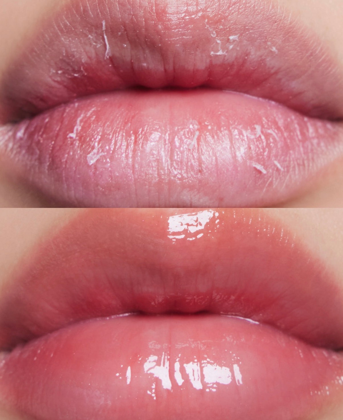Lip Mask