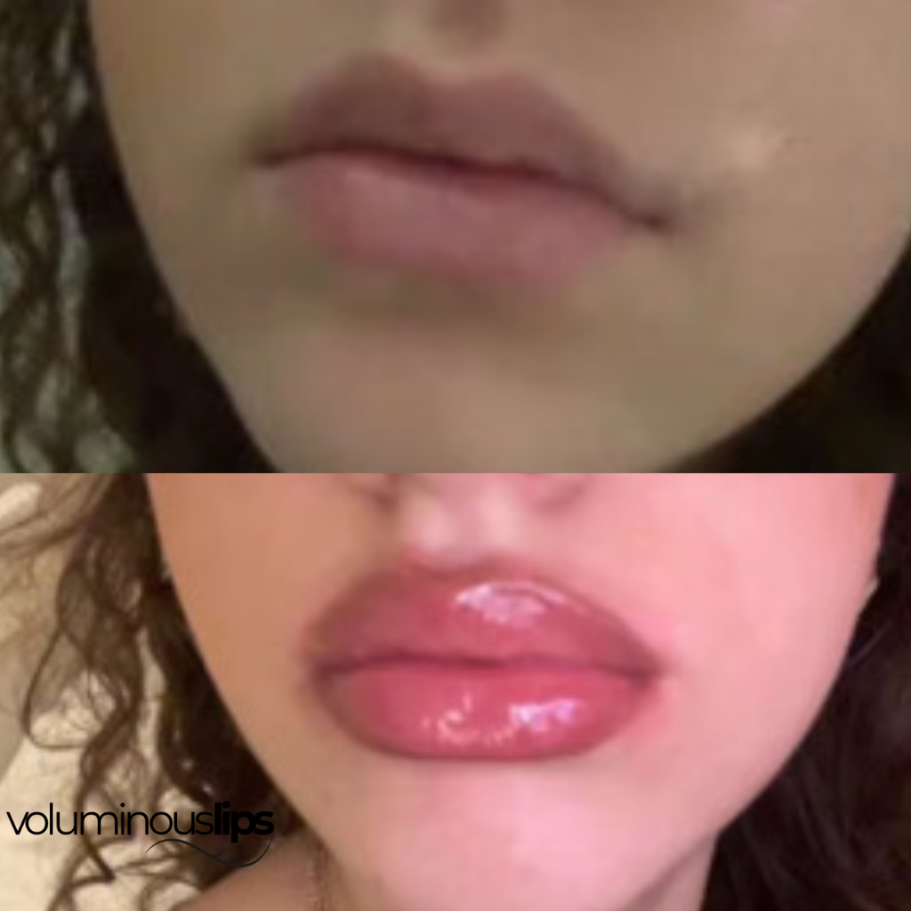 Voluminous Lips