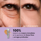 Tensor de Ojos Temporario – Efecto Firmeza